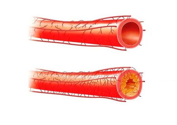 problems with potential consequences of blood vessels